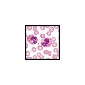 Eosinophil Stain (Hansel), 4oz.